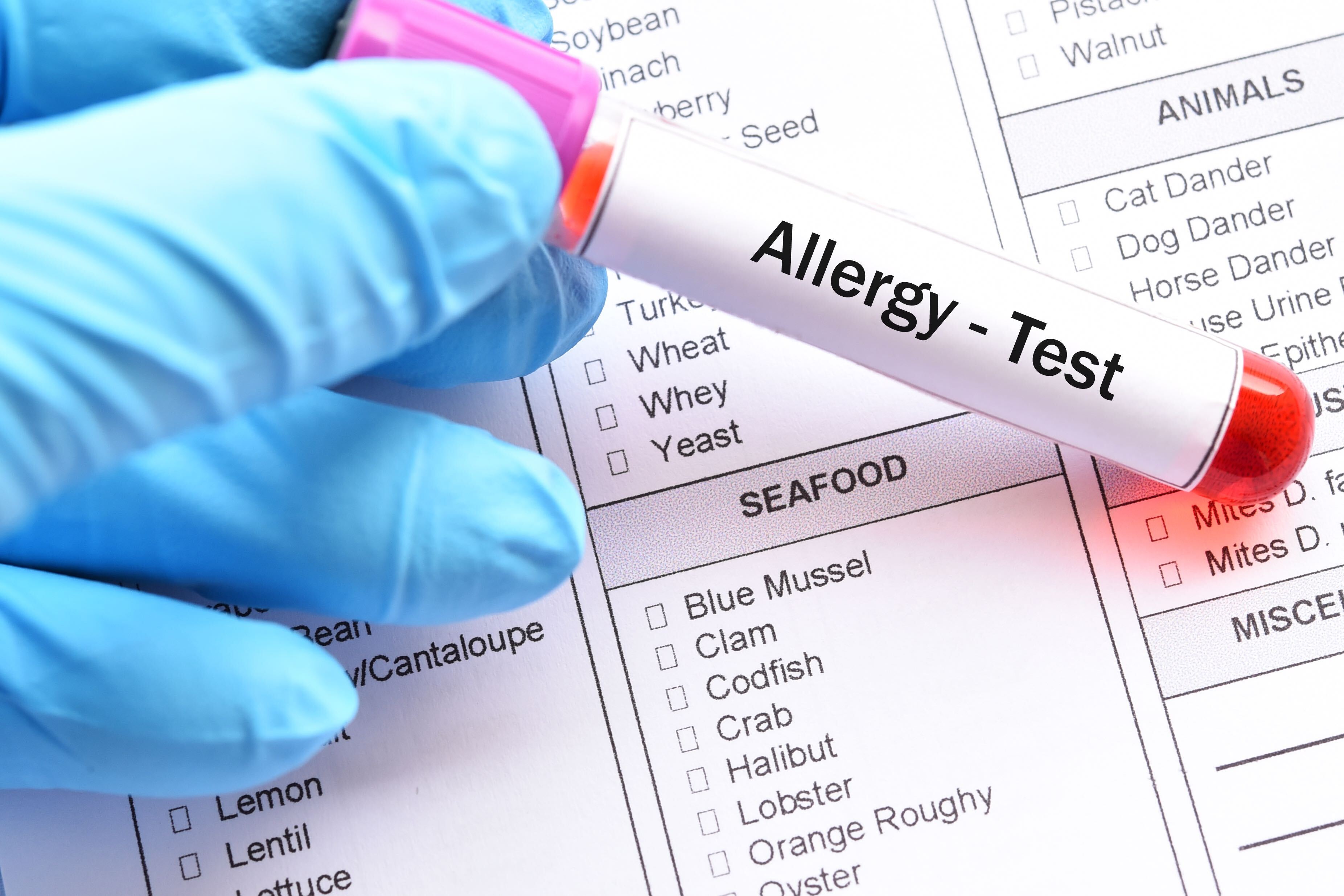 allergy blood test